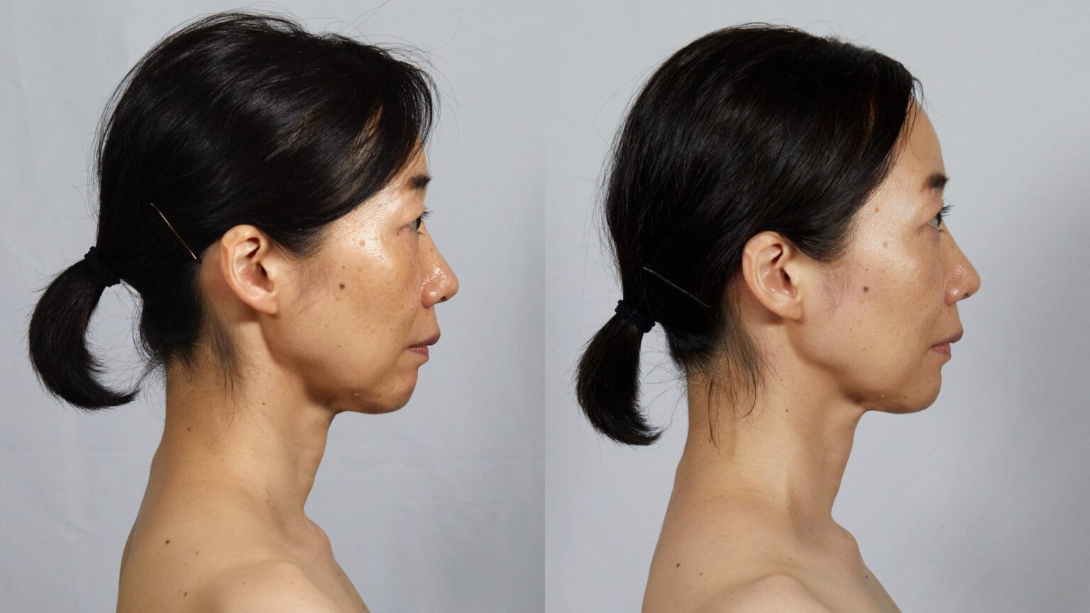 Face Player II