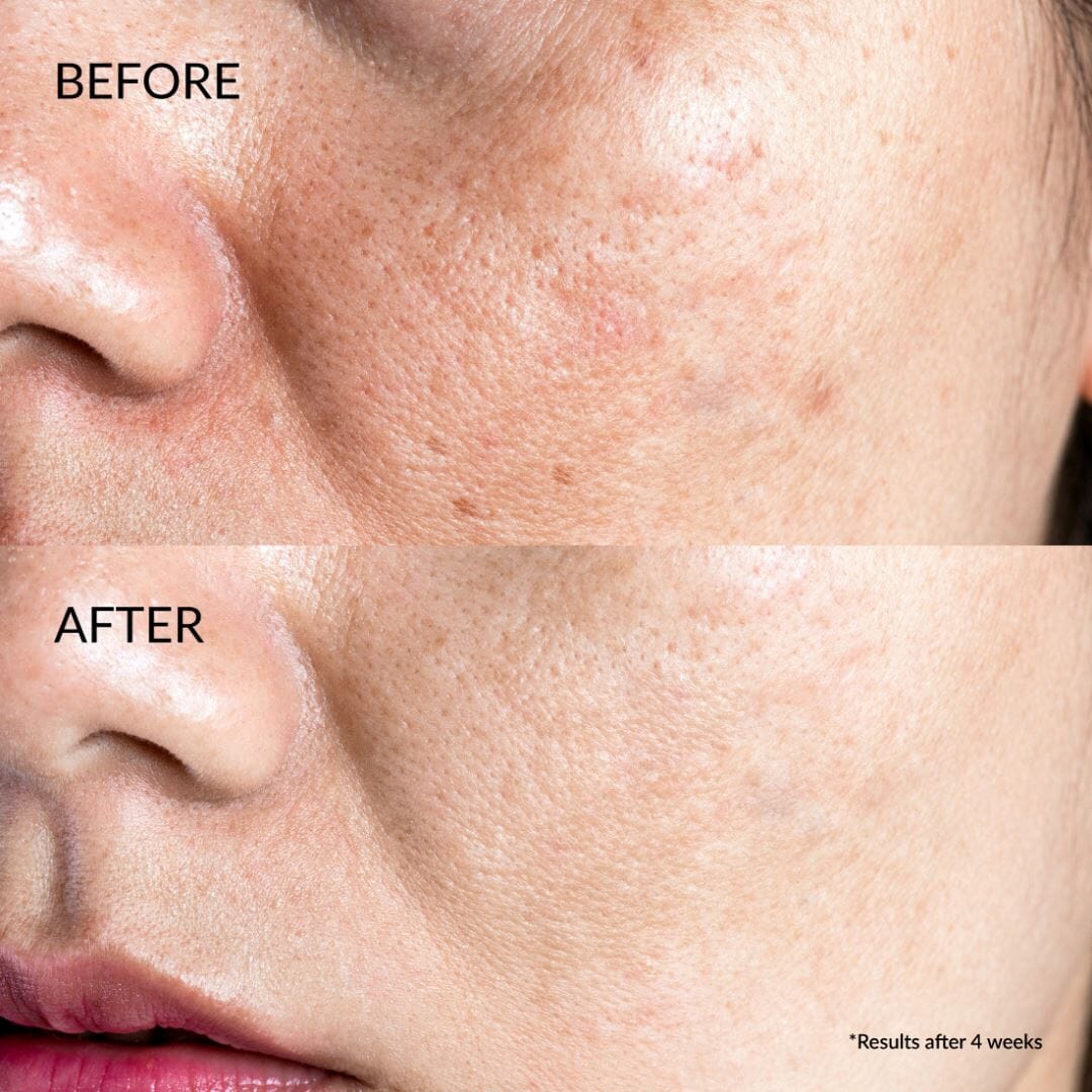 Kit Découvert Soin Anti-âge GLOW UP 8ml IREN Shizen