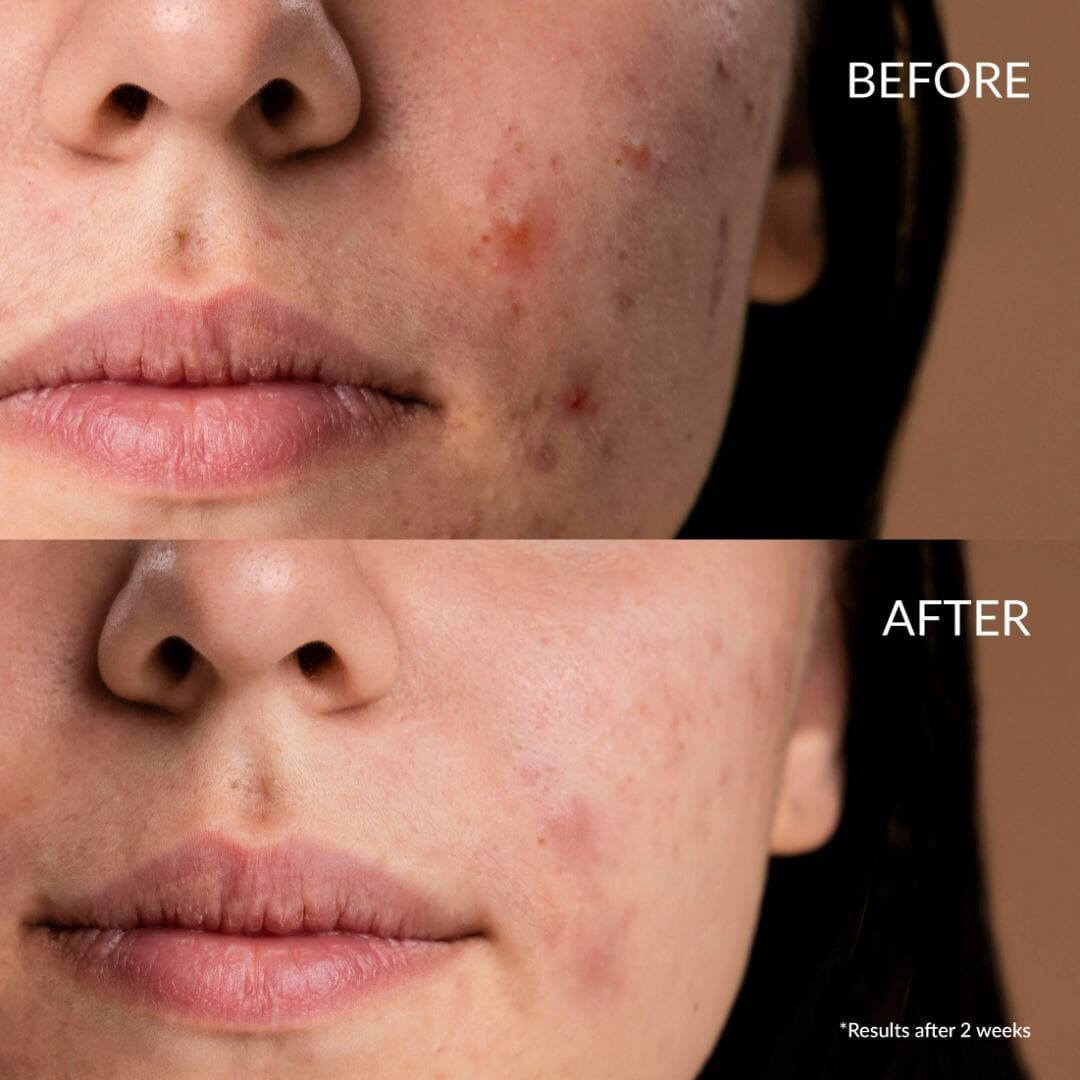 Kit Découvert Soin Anti-imperfections CLEAR UP IREN Shizen