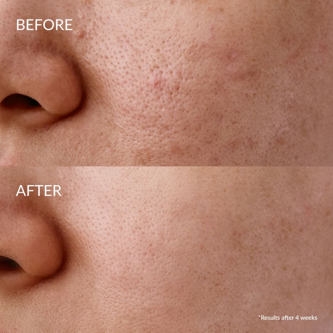 Kit Découvert Soin Anti-imperfections CLEAR UP IREN Shizen