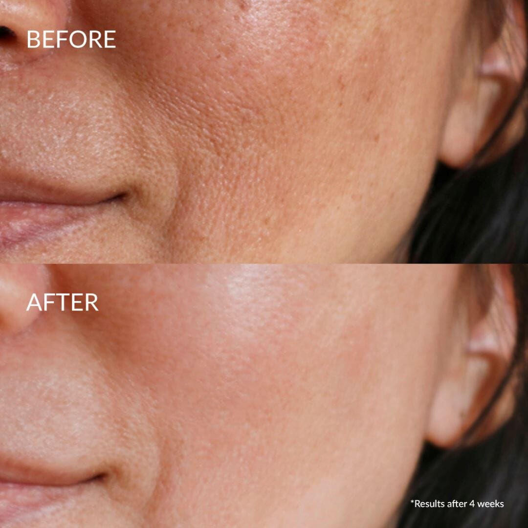 Kit Découvert Soin Hydratant DEW UP IREN Shizen