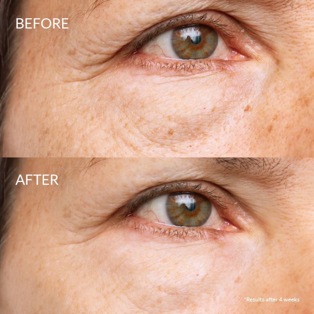 SKIN REBOOT Sérum antioxydant 20 ml IREN Shizen