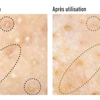Sérum-Huile Exfoliant et Nettoyant pour les Pores 40ml