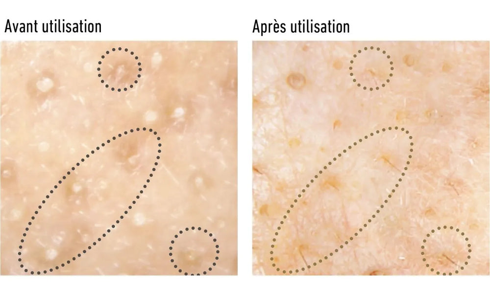 Sérum-Huile Exfoliant et Nettoyant pour les Pores 40ml