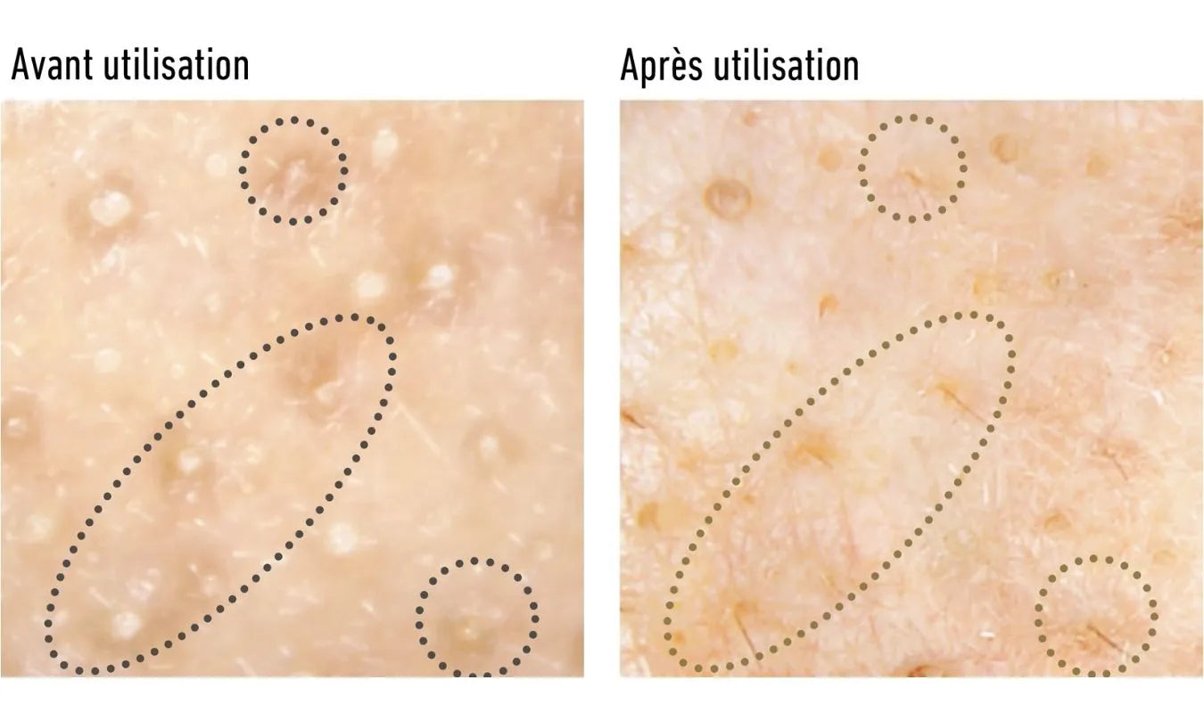 Sérum-Huile Exfoliant et Nettoyant pour les Pores 40ml