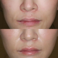 FREEZE THE YOUTH Firming Moisturizing Cream