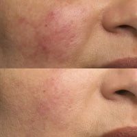 DROP OF DEW Moisturizing Face Oil