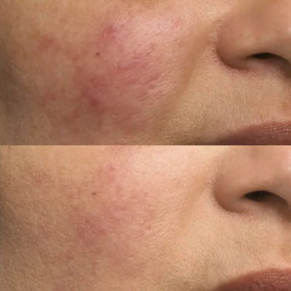 DROP OF DEW Moisturizing Face Oil