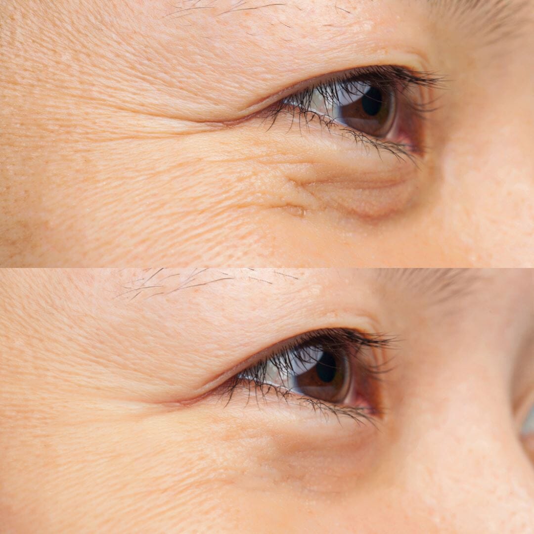 Kit Découvert Soin Anti-âge GLOW UP 8ml IREN Shizen