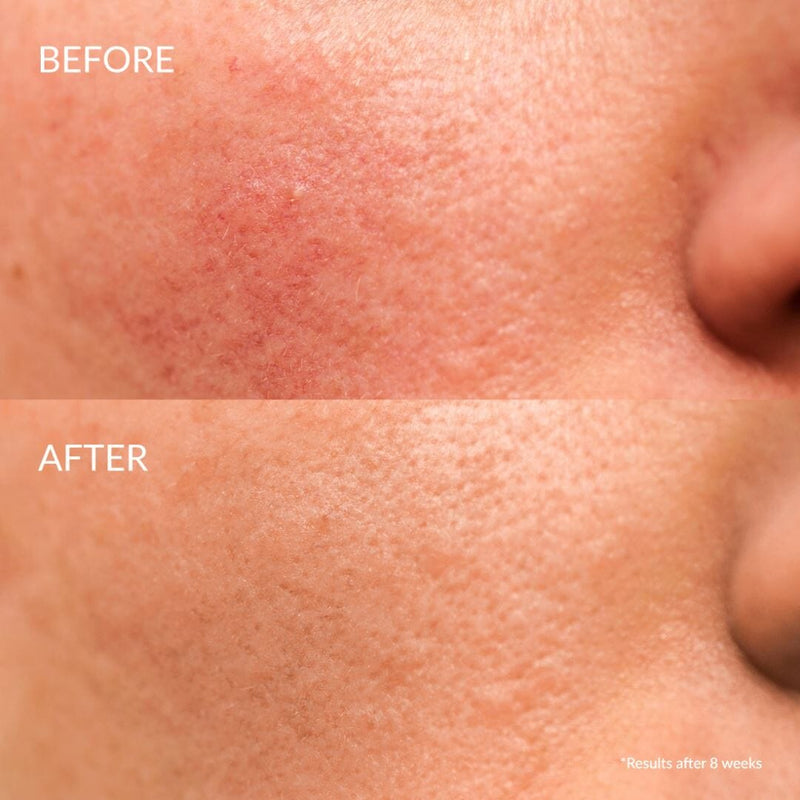 Kit Découvert Soin Anti-imperfections CLEAR UP IREN Shizen 