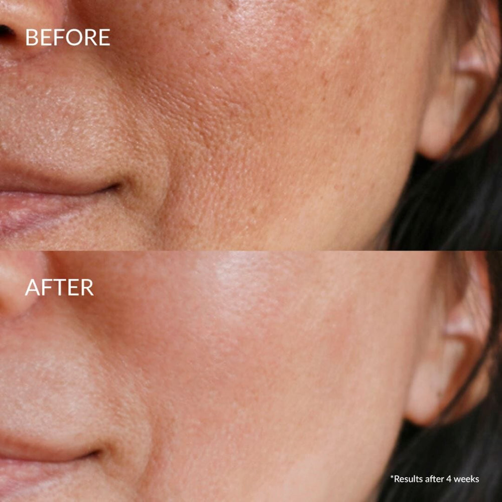 QUENCH-UP Sérum hydratant 20ml IREN Shizen